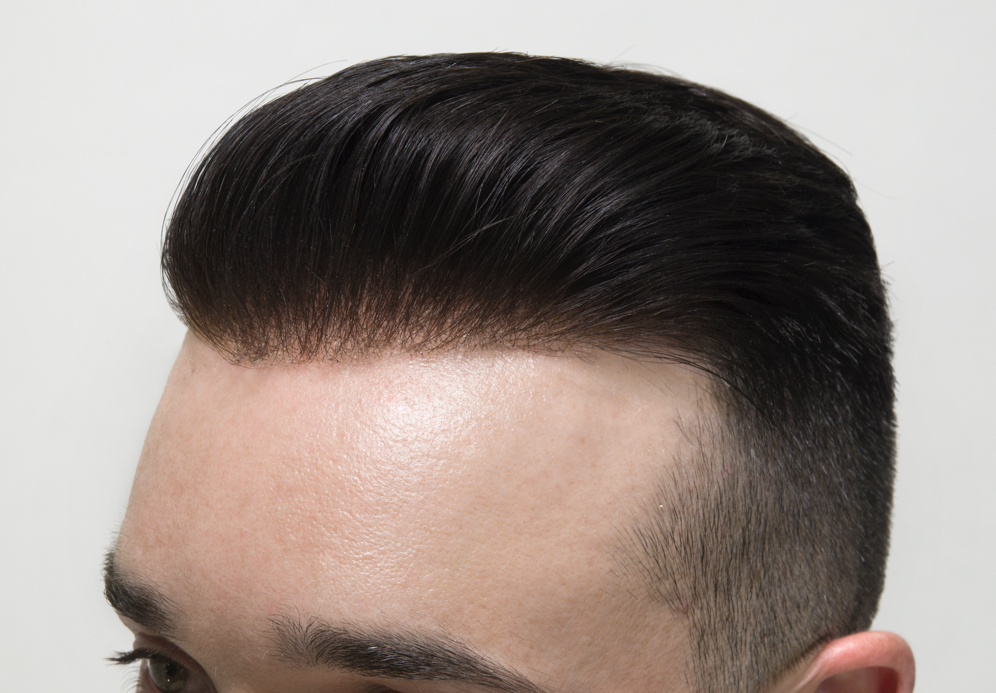 Custom Hair Systems - Complete Guide