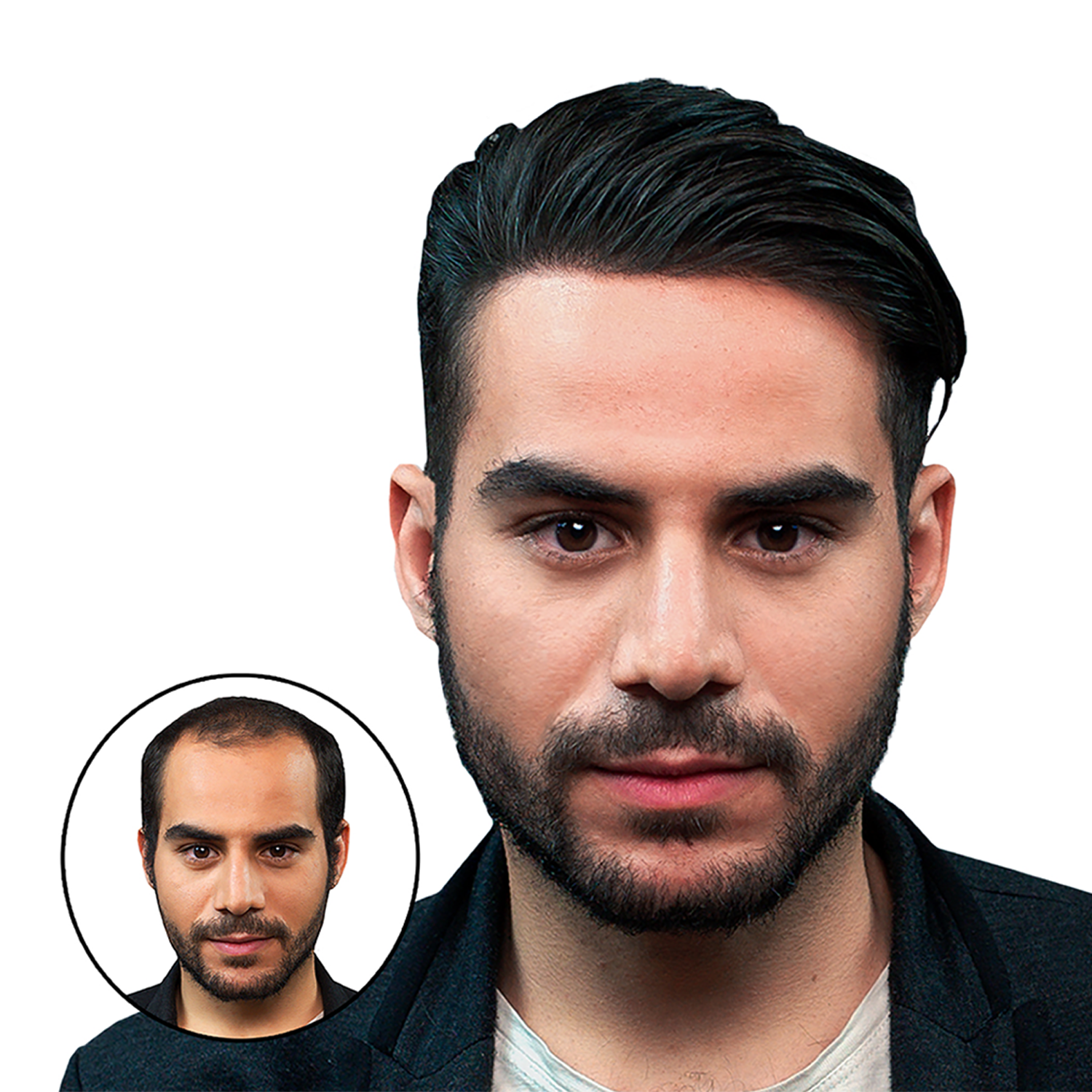 Hair system before and after transformation