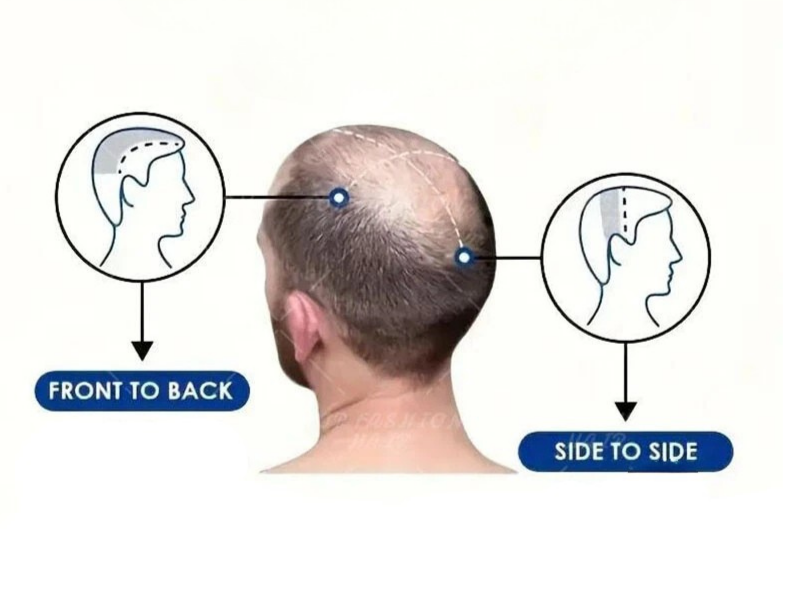 Hair system sizing and measurement guide illustration