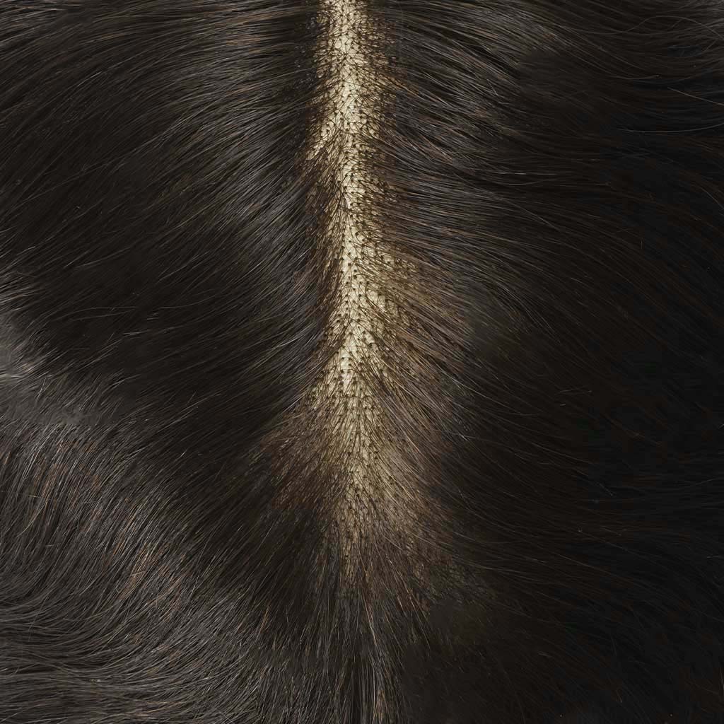 Lace Fusion VF