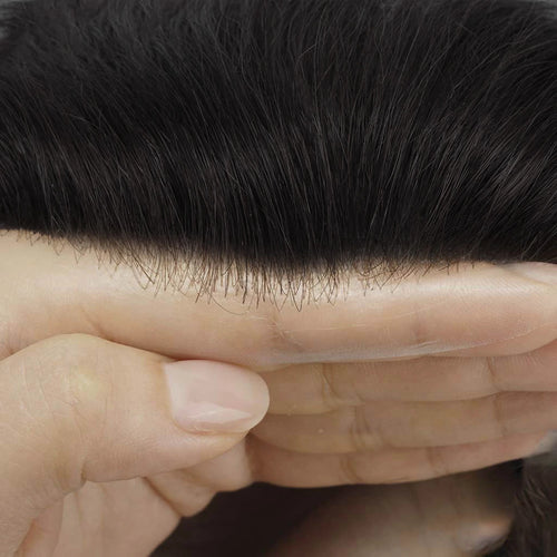 Hair System Hairline Shot