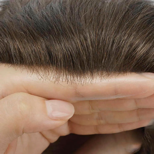 Hair System Hairline Shot
