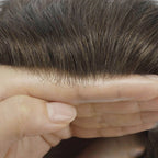 Hair System Hairline Shot